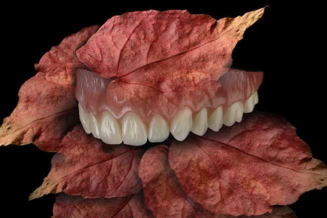 Präzise Zahntechnik für die smile-Schiene